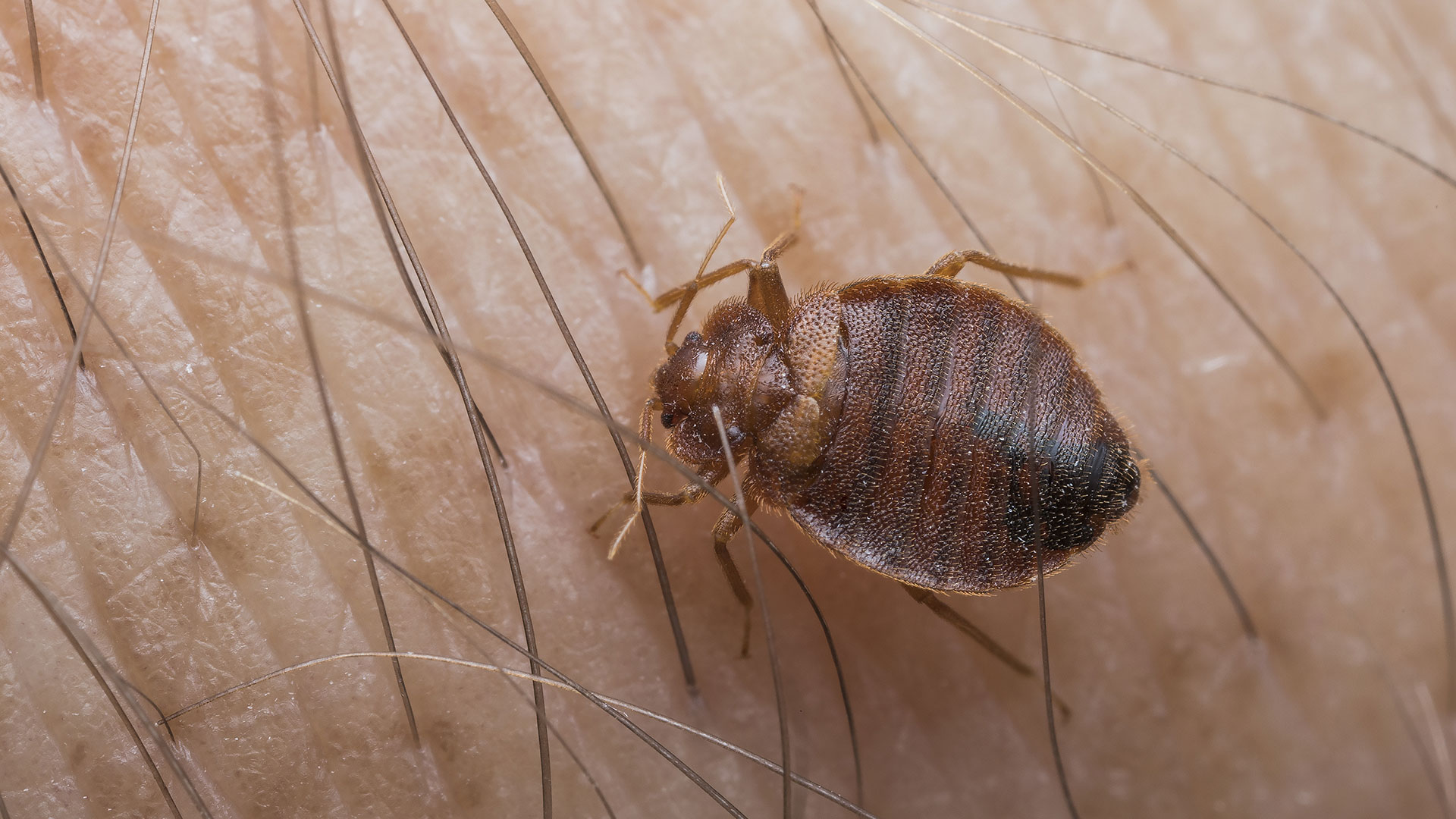 Got Bed Bugs? Don’t Panic - Here’s What to Do